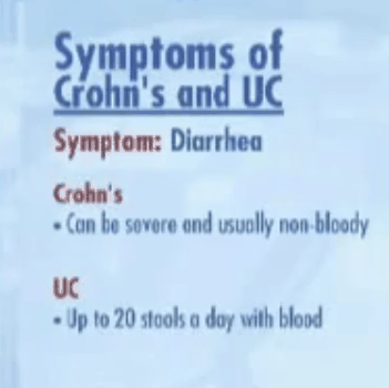 Comparing Crohn's and Ulcerative Colitis